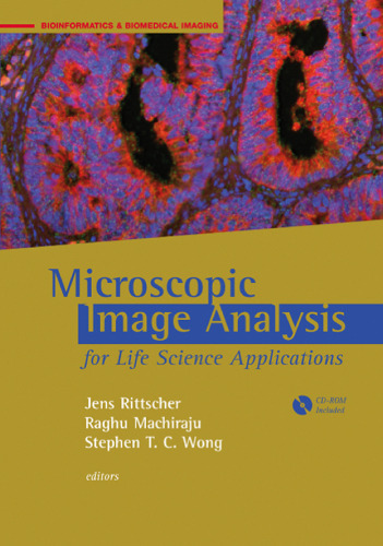 Microscopic Image Analysis for Life Science Applications (Bioinformatics & Biomedical Imaging)