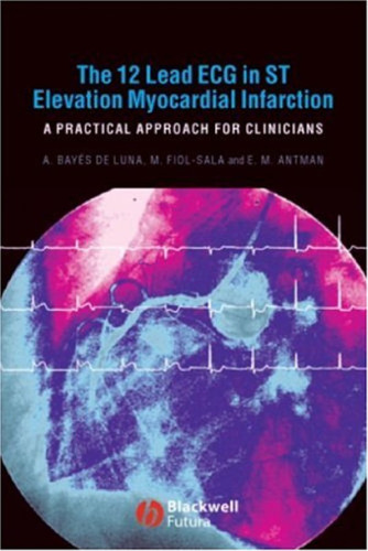 The 12 Lead ECG in ST Elevation Myocardial Infarction: A Practical Approcah for Clinicians