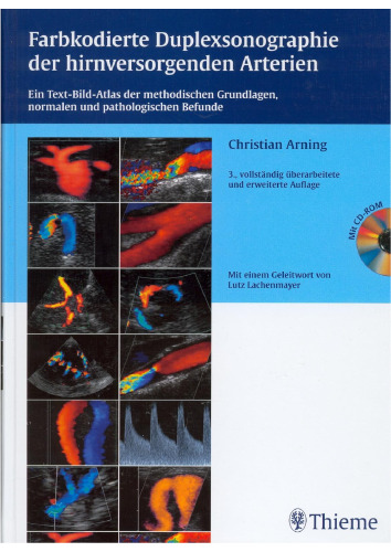 Farbkodierte Duplexsonographie der hirnversorgenden Arterien
