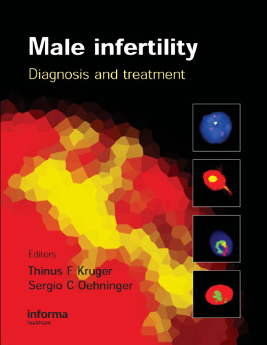 Male Infertility: Diagnosis and Treatment