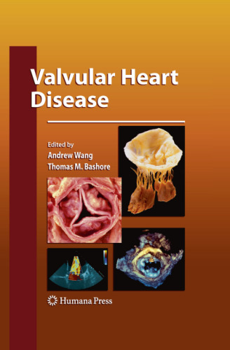 Valvular Heart Disease