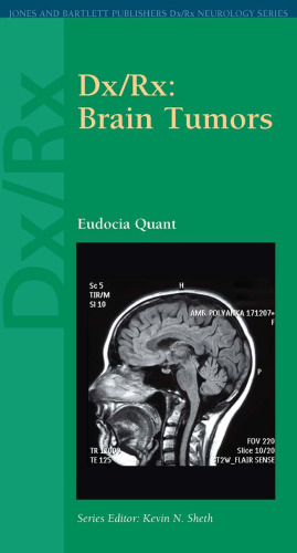 Dx Rx: Brain Tumors (Dx Rx Neurology Series)