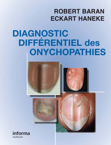 Diagnostic Différentiel des Onychopathies