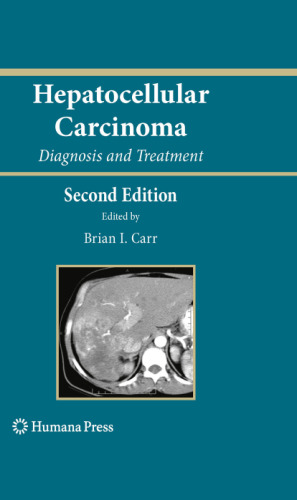 Hepatocellular Carcinoma: Diagnosis and Treatment
