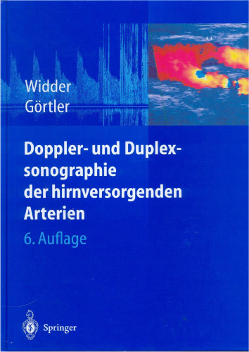 Doppler- und Duplexsonographie der hirnversorgenden Arterien 6. Auflage