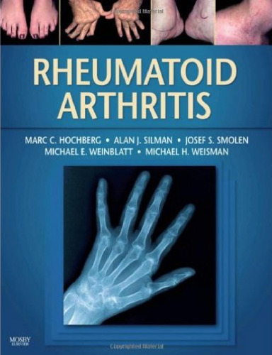 Rheumatoid Arthritis