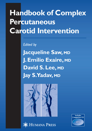Handbook of Complex Percutaneous Carotid Intervention (Contemporary Cardiology)
