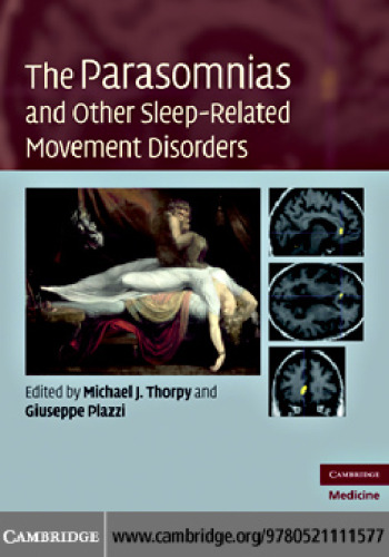 The Parasomnias and Other Sleep-Related Movement Disorders