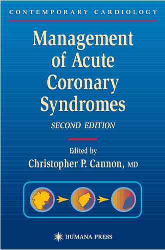Management of Acute Coronary Syndromes (Contemporary Cardiology)