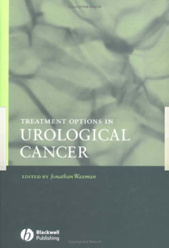 Treatment Options in Urological Cancer