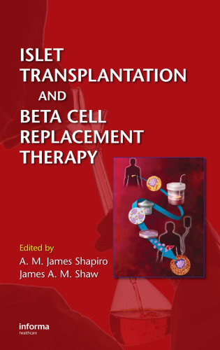 Islet Transplantation and Beta Cell Replacement Therapy