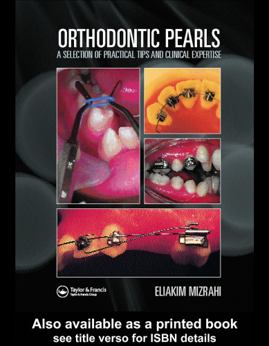 Orthodontic Pearls A Selection of Practical Tips and Clinical Expertise