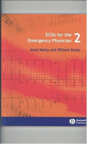 ECGs for the Emergency Physician 2