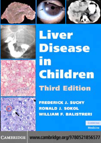 Liver Disease in Children