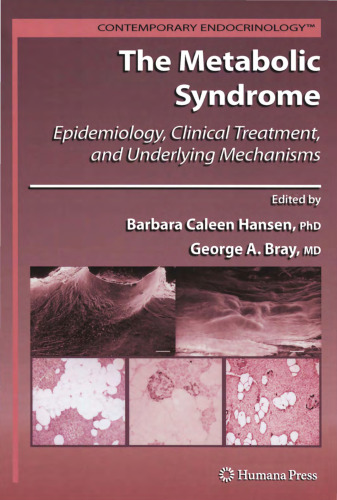 The Metabolic Syndrome: Epidemiology, Clinical Treatment, and Underlying Mechanisms (Contemporary Endocrinology)