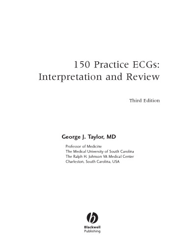 150 Practice ECGs: Interpretation and Review