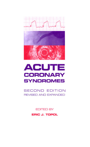 Acute Coronary Syndromes, Third Edition