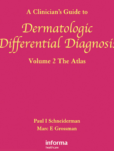 A Clinician's Guide to Dermatologic Differential Diagnosis, Volume 2: The Atlas (Encyclopedia of Differential Diagnosis in Dermatology)