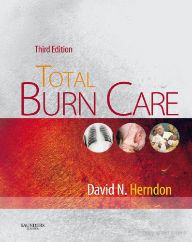Total Burn Care,Third Edition