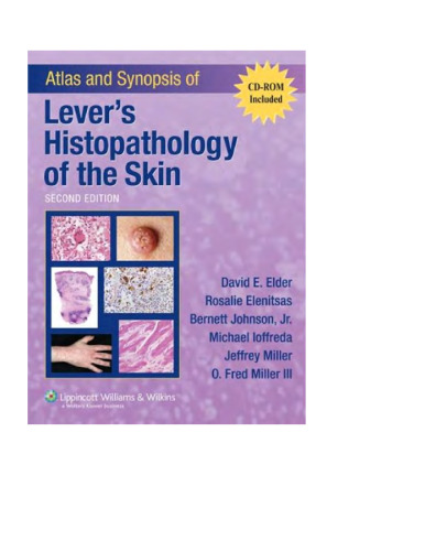 Atlas and Synopsis of Lever's Histopathology of the Skin, 2nd Edition