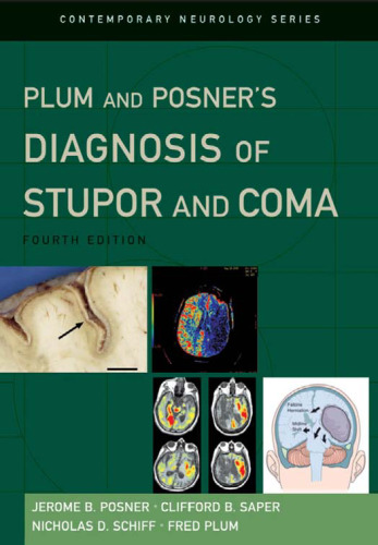 Plum and Posner's Diagnosis of Stupor and Coma (Contemporary Neurology71)