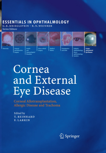 Cornea and External Eye Disease: Corneal Allotransplantation, Allergic Disease and Trachoma