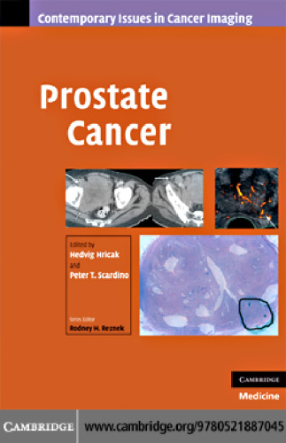 Prostate Cancer (Contemporary Issues in Cancer Imaging)