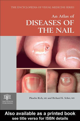 An Atlas of Diseases of the Nail (Encyclopedia of Visual Medicine Series)
