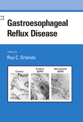 Gastroesophageal Reflux Disease (Gastroenterology and Hepatology)