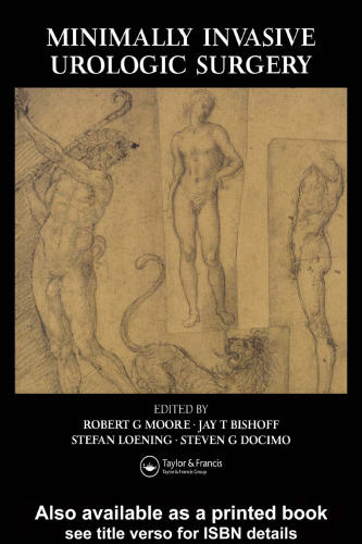 Minimally Invasive Urological Surgery