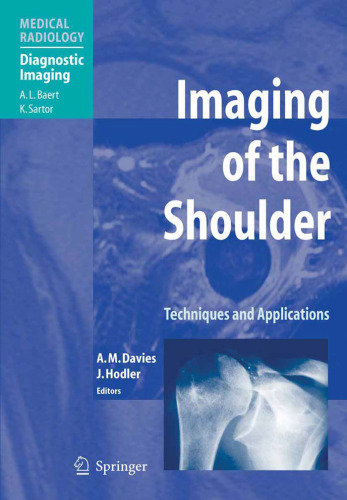 Imaging of the Shoulder: Techniques and Applications (Medical Radiology   Diagnostic Imaging)