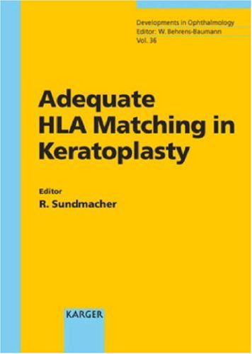 Adequate HLA Matching in Keratoplasty (Developments in Ophthalmology, 36)