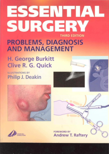 Essential Surgery: Problems, Diagnosis and Management, Third Edition