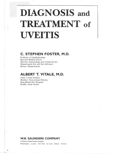 Diagnosis and Treatment of Uveitis