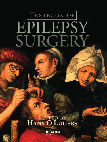 Textbook of Epilepsy Surgery