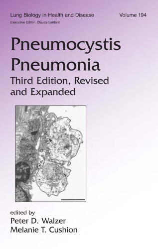 Pneumocystis  Pneumonia, 3rd Edition (Lung Biology in Health and Disease)