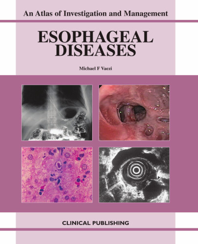 Esophageal Diseases: An Atlas of Investigation and Management
