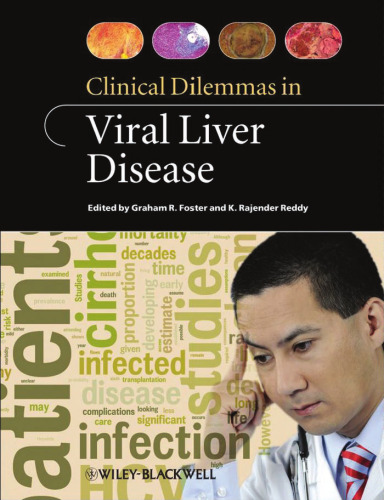 Clinical Dilemmas in Viral Liver Disease