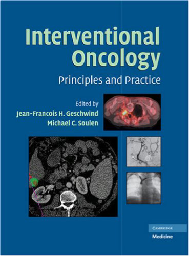 Interventional Oncology: Principles and Practice
