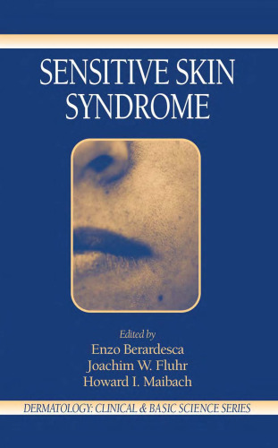 Sensitive Skin Syndrome (Dermatology: Clinical & Basic Science)