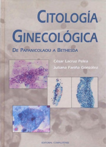 Citología Ginecológica: De Papanicolau a Bethesda