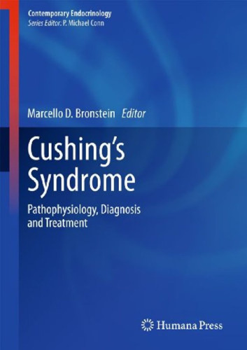 Cushing's Syndrome: Pathophysiology, Diagnosis and Treatment