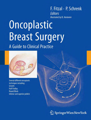 Oncoplastic Breast Surgery: A Guide to Clinical Practice