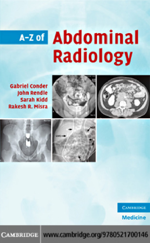 A-Z of Abdominal Radiology