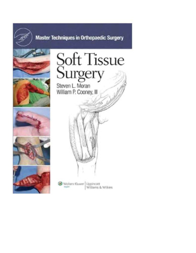 Master Techniques in Orthopaedic Surgery: Soft Tissue Surgery (Master Techniques in Orthopaedic Surgery)