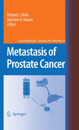 Metastasis of Prostate Cancer (Cancer Metastasis - Biology and Treatment)