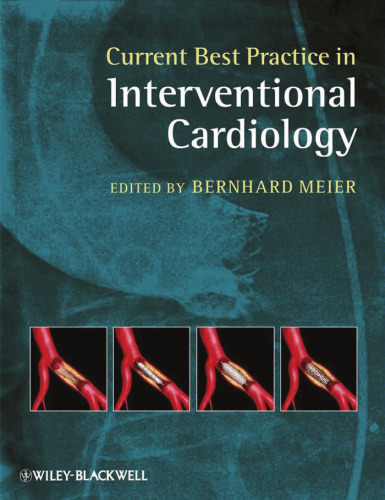 Current Best Practice in Interventional Cardiology