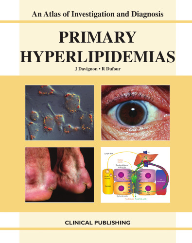 Primary Hyperlipidemias: An Atlas Of Investigation And Diagnosis