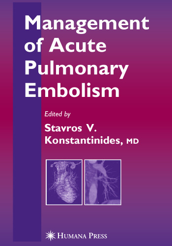 Management of Acute Pulmonary Embolism (Contemporary Cardiology)