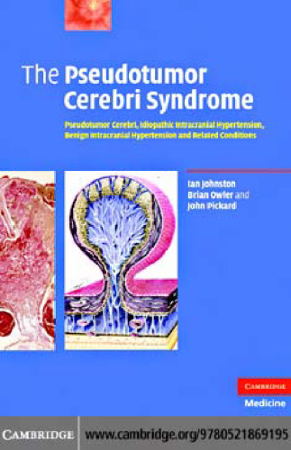 The Pseudotumor Cerebri Syndrome: Pseudotumor Cerebri, Idiopathic Intracranial Hypertension, Benign Intracranial Hypertension and Related Conditions